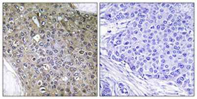 TGFβ RIII (phospho Thr842) rabbit pAb