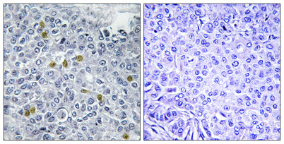 Topo IIα (phospho Ser1106) rabbit pAb