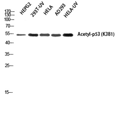 p53 (Acetyl Lys381) rabbit pAb