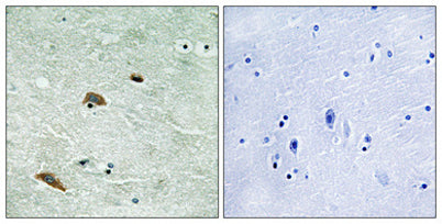 TTK (phospho Thr676) rabbit pAb