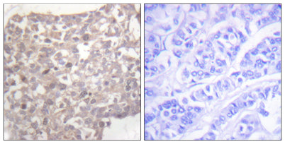 Tubulin γ rabbit pAb