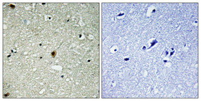 HIRA (phospho Thr555) rabbit pAb