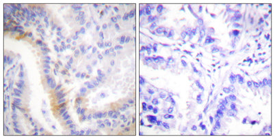Urocortin rabbit pAb