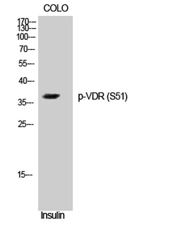 VDR (phospho Ser51) rabbit pAb