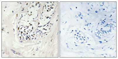 ZNF23 rabbit pAb