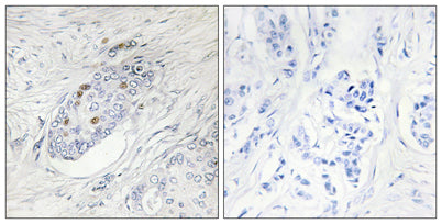 ZNF232 rabbit pAb