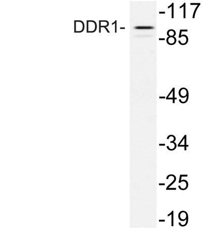 DDR1 rabbit pAb