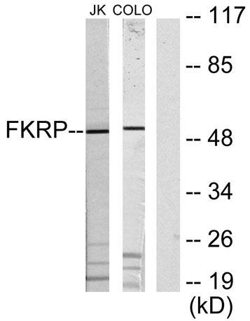 FKRP rabbit pAb