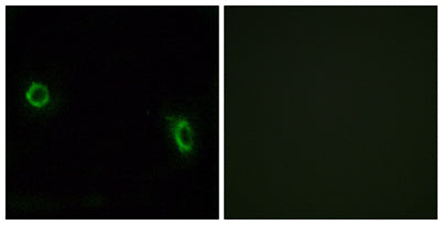 Olfactory receptor 6J1 rabbit pAb