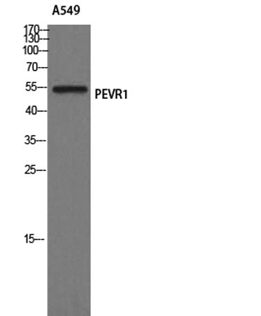 GPR172A rabbit pAb