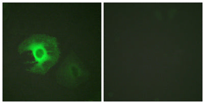 Caldesmon rabbit pAb