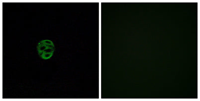 Olfactory receptor 2AE1 rabbit pAb
