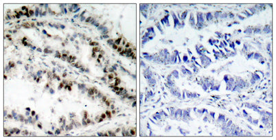 SMC1 (phospho Ser957) rabbit pAb