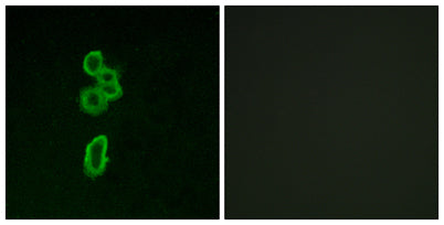 Frizzled-6 rabbit pAb