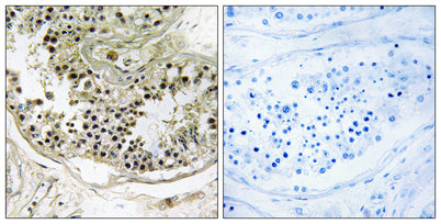 Dynein LC 2B rabbit pAb