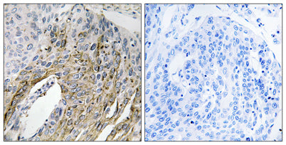 LONP2 rabbit pAb