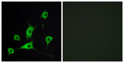 CRBP-III rabbit pAb
