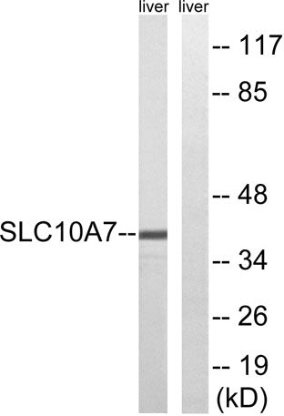 SLC10A7 rabbit pAb