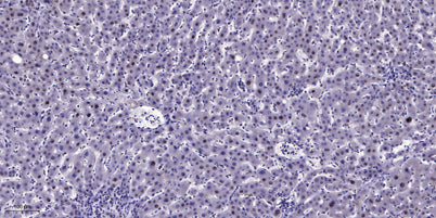 CHD9 rabbit pAb