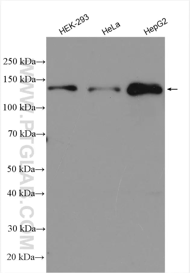MKL1 Polyclonal antibody