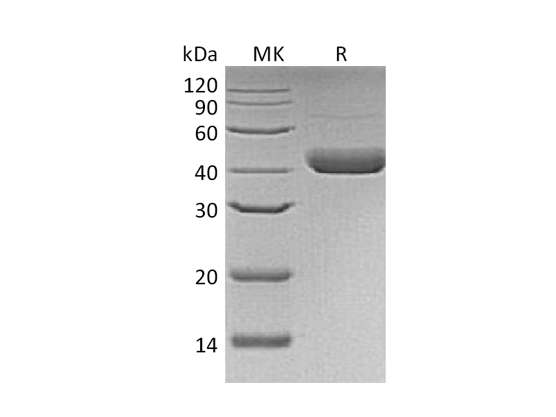 Recombinant Human Decorin (C-6His,Baculovirus)