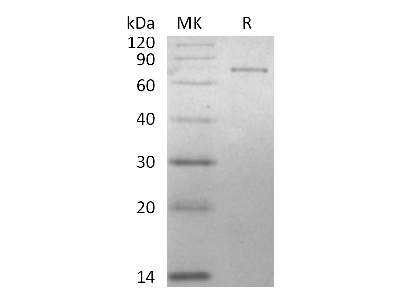 Recombinant Human MetAP2 (N-6His)