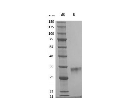 Recombinant Human OSM