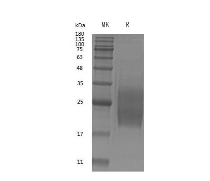 GMP Recombinant Human GM-CSF