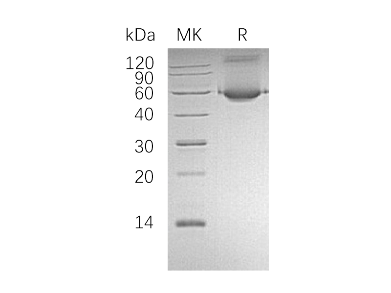Recombinant Human ALDH1A1 (N-6His)