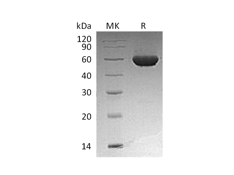 Recombinant Human ALDH1A2 (N-6His)
