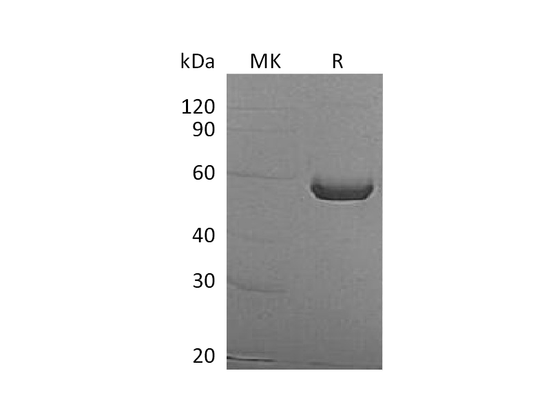 Recombinant Human ALDH1A3 (N-6His)