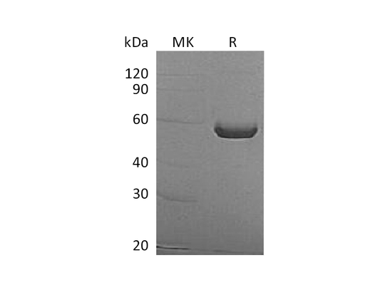 Recombinant Human ALDH1A3 (N-6His)