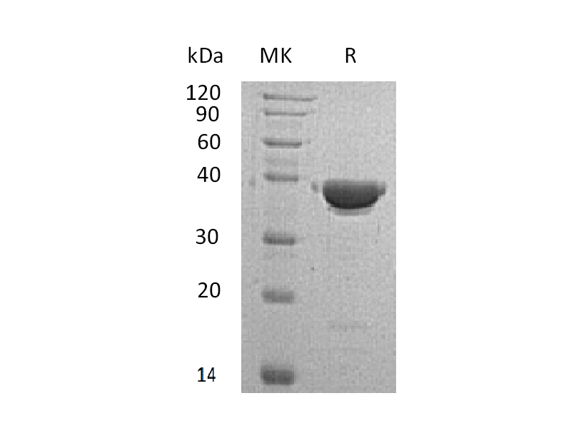 Recombinant Human AKR1C4 (N-6His)