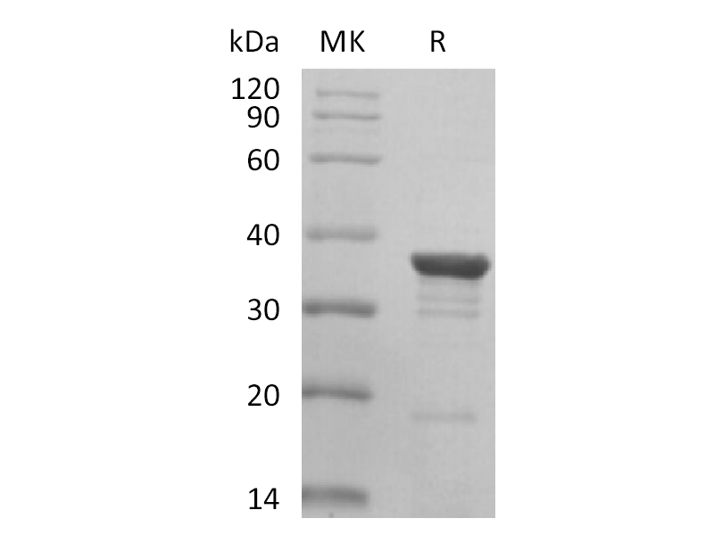 Recombinant Human AKR1C2