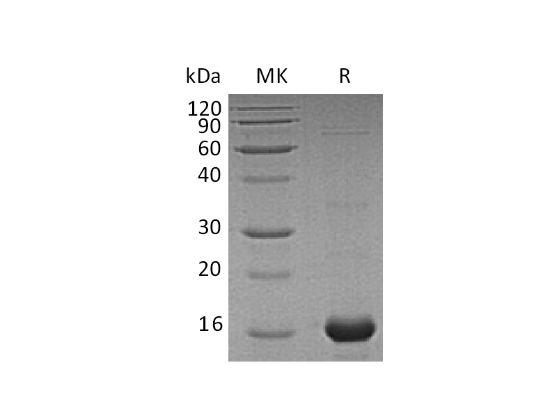 Recombinant Human AIF1 (C-6His)