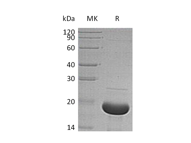 Recombinant Human SNCA (N-6His)