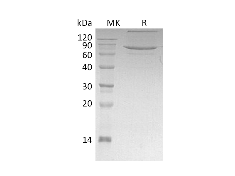 Recombinant Human XPNPEP1 (C-6His)