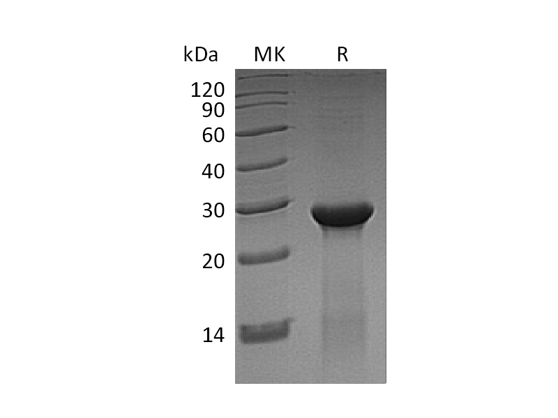 Recombinant Human ASB13 (N-6His)