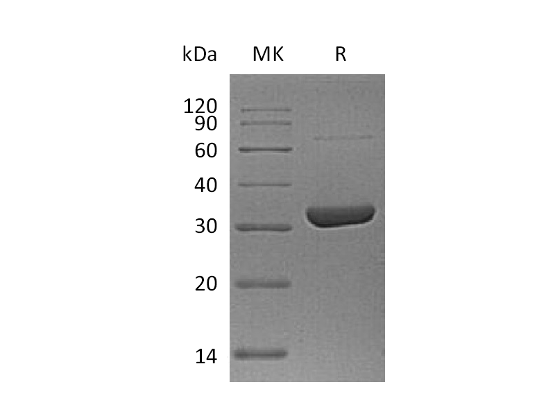 Recombinant Human ANXA10