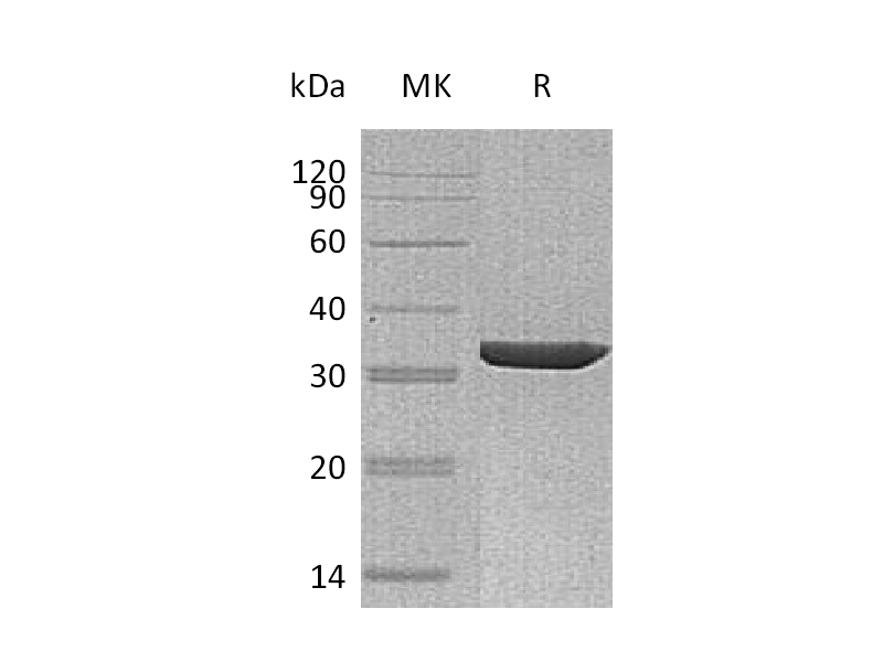 Recombinant Human ANXA3
