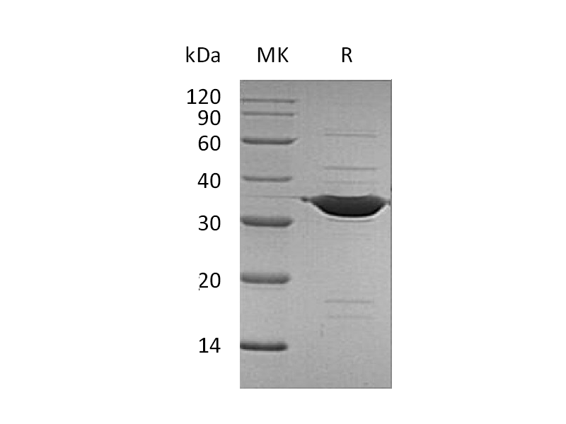 Recombinant Human ANXA5