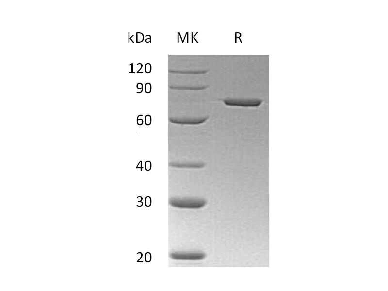 Recombinant Human ANXA6 (C-6His)