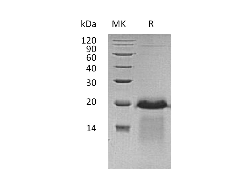 Recombinant Human APBA3 (C-6His)