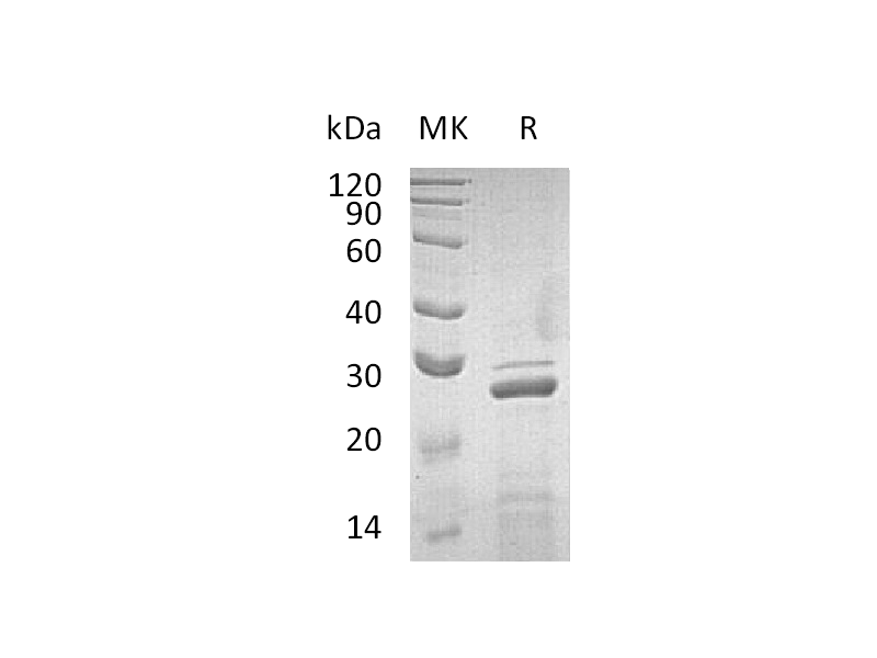 Recombinant Human ApoA1