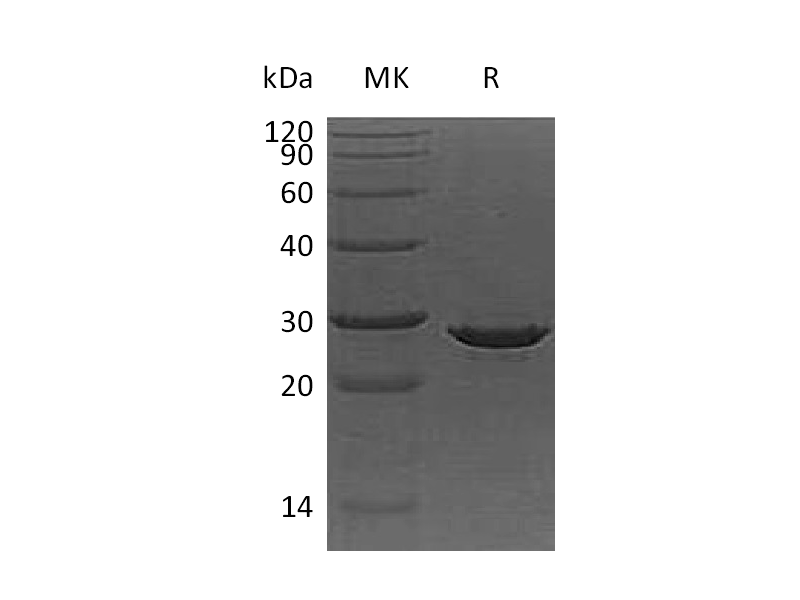 Recombinant Human ApoA1 (C-6His)