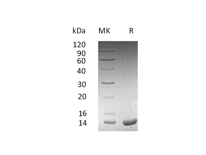 Recombinant Human ApoC2 (C-6His)