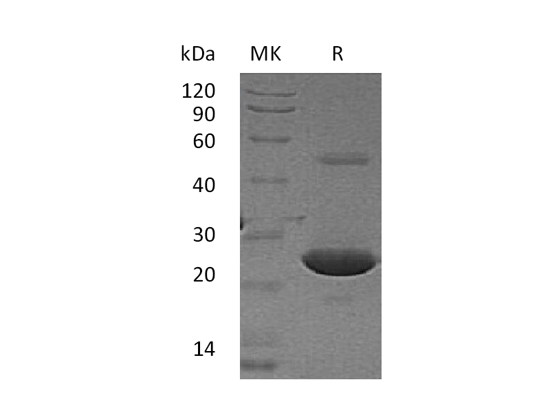 Recombinant Human APT-1 (N-6His)