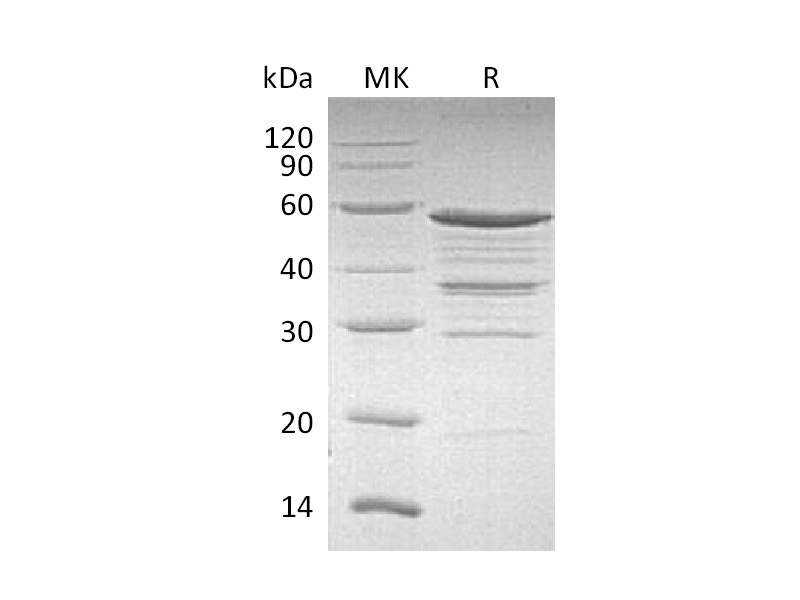 Recombinant Human NOL3 (N-GST)