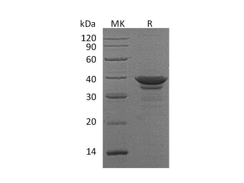 Recombinant Human ARG1 (C-6His)