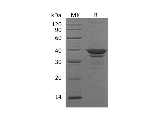 Recombinant Human ARG1 (C-6His)